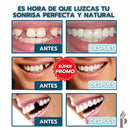 [PAGA 1 Y LLEVA 2] Carillas Dentales Ajustables – Sonrisa Perfecta al Instante | Snap-On Smile
