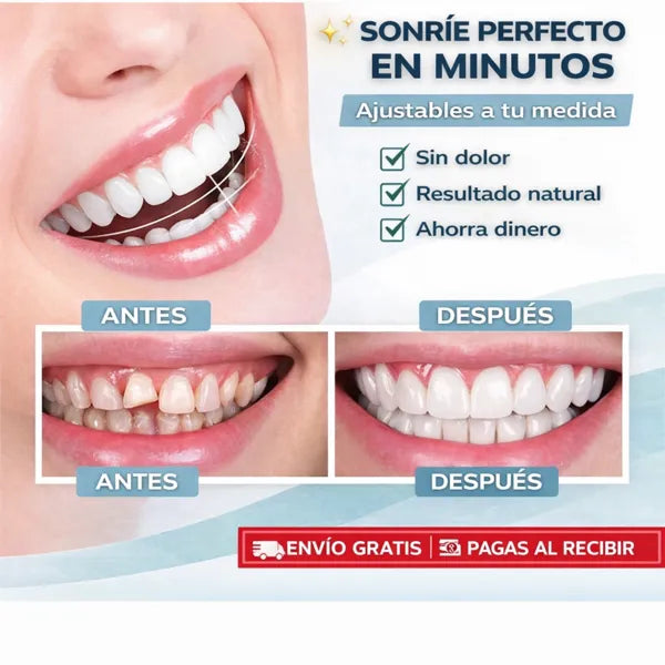 [PAGA 1 Y LLEVA 2] Carillas Dentales Ajustables – Sonrisa Perfecta al Instante | Snap-On Smile